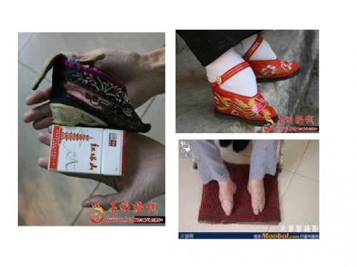 自制残害妇女裹脚