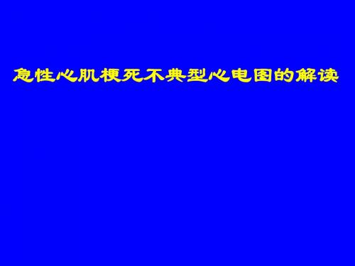 AMI不典型心电图的解读