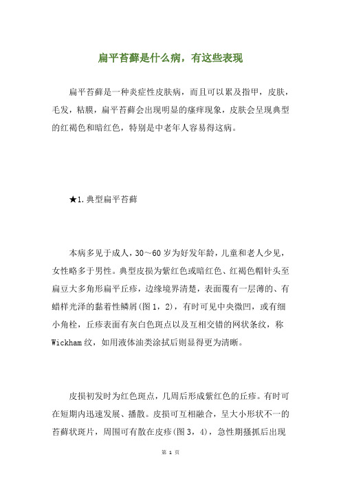 扁平苔藓是什么病,有这些表现