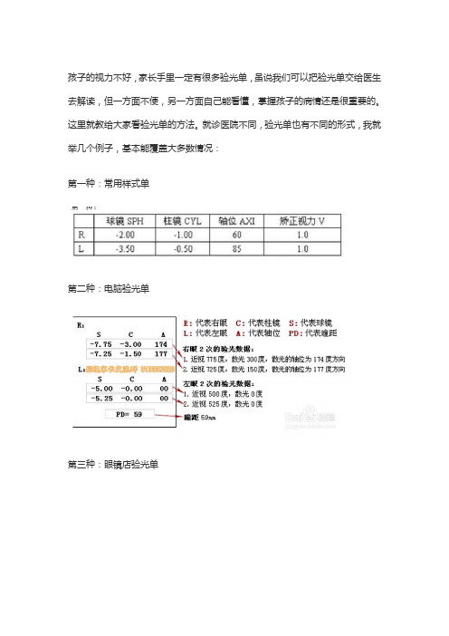看懂验光单