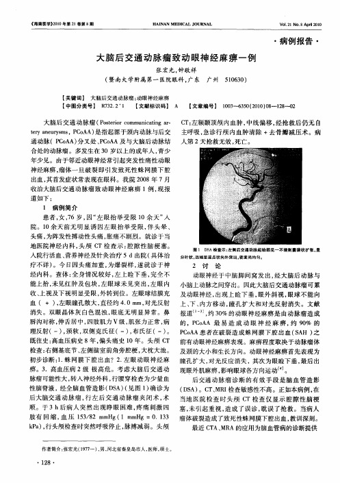 大脑后交通动脉瘤致动眼神经麻痹一例