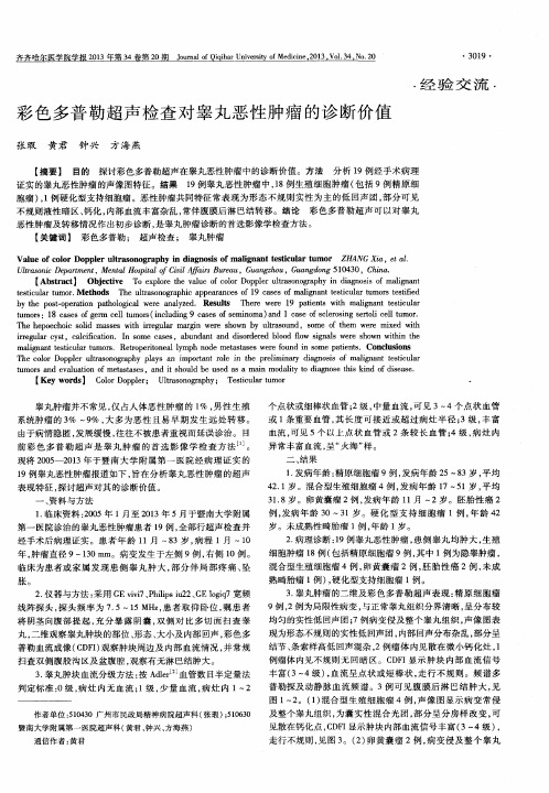 彩色多普勒超声检查对睾丸恶性肿瘤的诊断价值