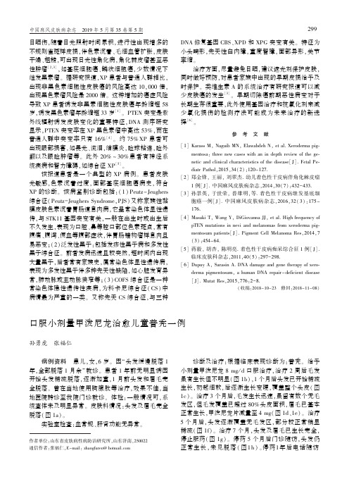 口服小剂量甲泼尼龙治愈儿童普秃一例