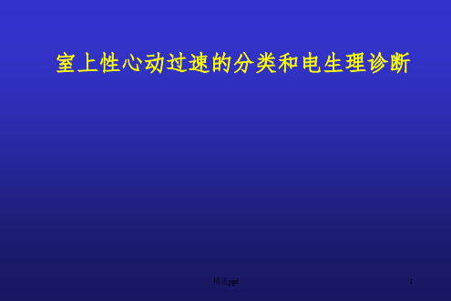 室上性心动过速分类