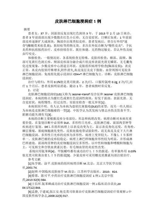 皮肤淋巴细胞浸润症1例