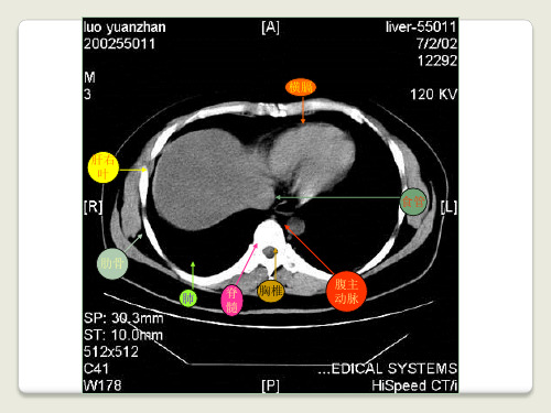 医学系列上腹部影像图谱