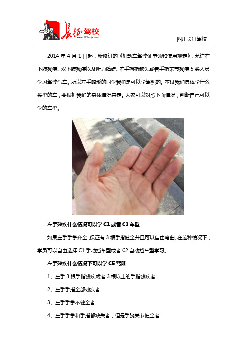 左手畸形可以考驾照吗