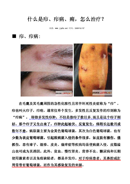 →什么是疖、疖病、痈,怎么治疗