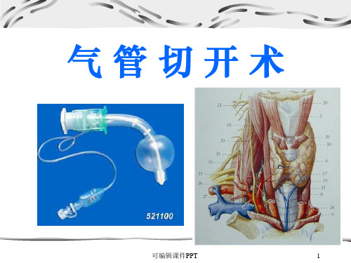 气管切开术.1ppt课件