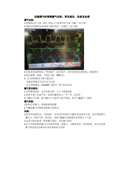 机械通气时管路漏气识别、常见部位及处理