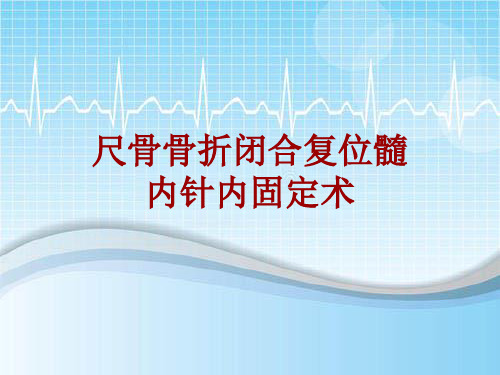 手术讲解模板：尺骨骨折闭合复位髓内针内固定术