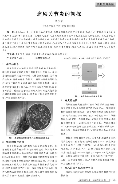 痛风关节炎的初探