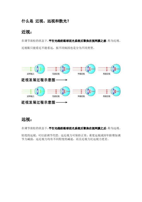 什么是 近视、远视和散光？