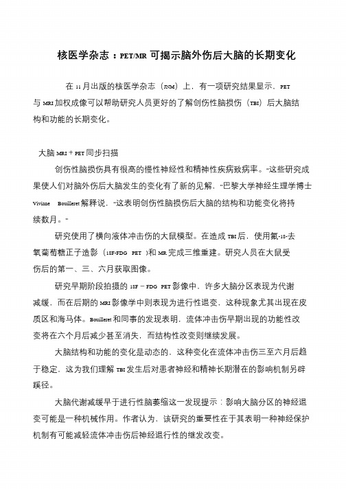 核医学杂志：PET-MR可揭示脑外伤后大脑的长期变化