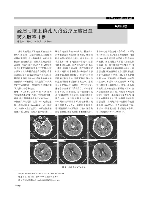 经眉弓眶上锁孔入路治疗丘脑出血破入脑室1例