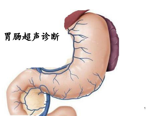胃肠超声诊断 ppt课件