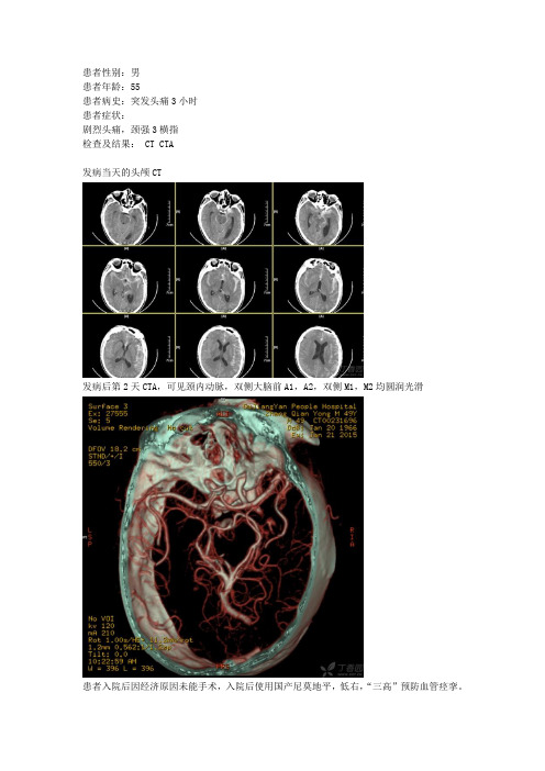 脑血管痉挛CVS