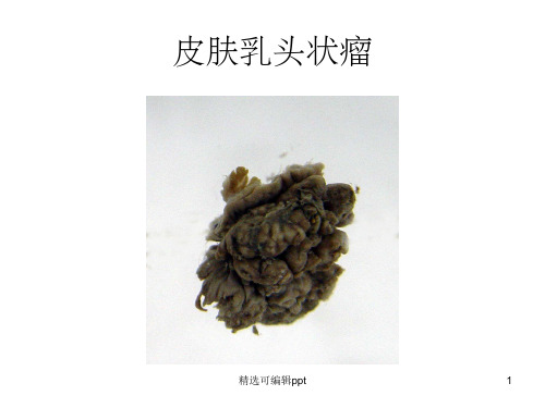 肿瘤病理图谱