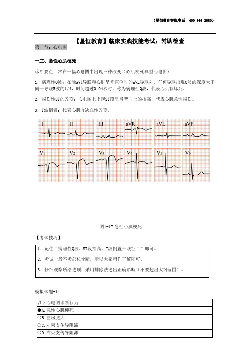 实践技能辅助检查之急性心肌梗死[临床实践技能考试]