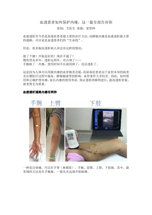 血透患者如何保护内瘘,这一篇全部告诉你