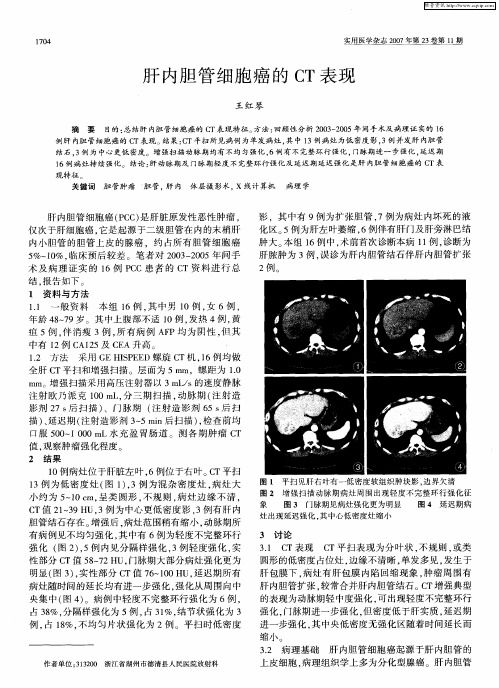 肝内胆管细胞癌的CT表现