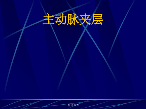 主动脉夹层
