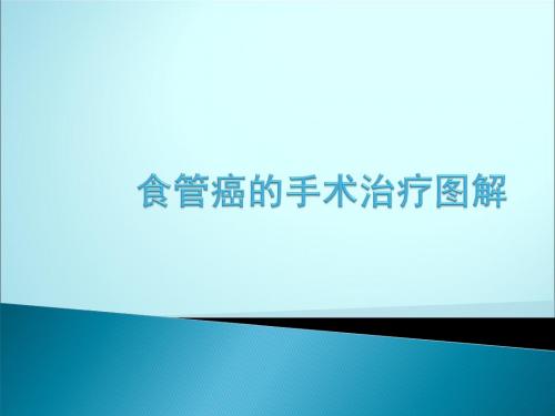 食管癌的手术治疗图解ppt课件