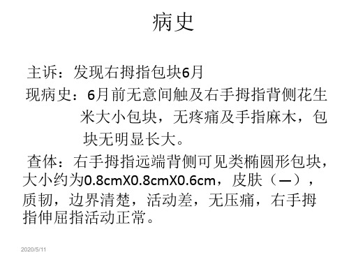 腱鞘巨细胞瘤课件