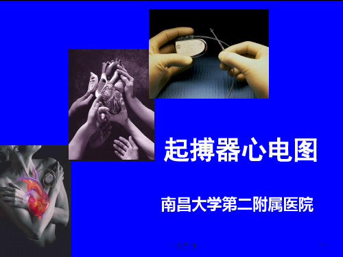 常见起搏器心电图解读[专家学习]