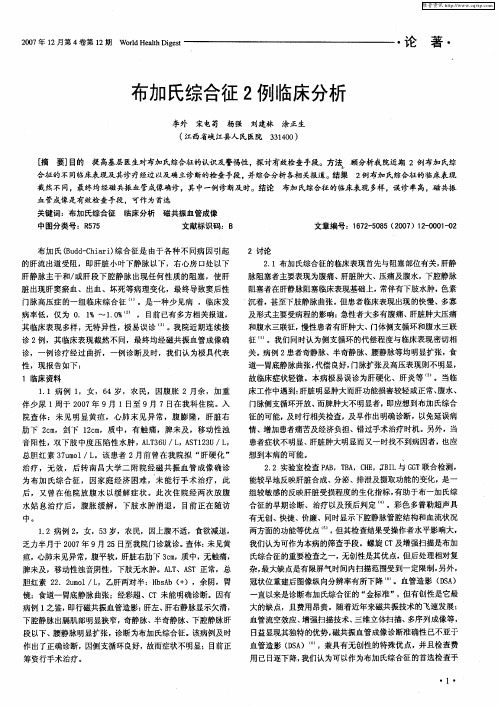 布加氏综合征2例临床分析