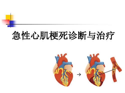 急性心肌梗死诊断与治疗(2021)
