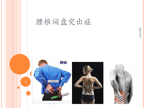 《腰椎间盘突出症》PPT课件
