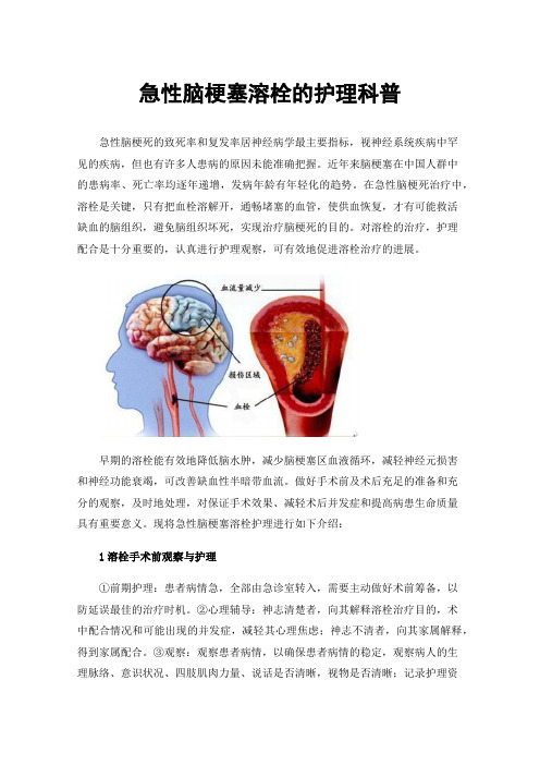 急性脑梗塞溶栓的护理科普