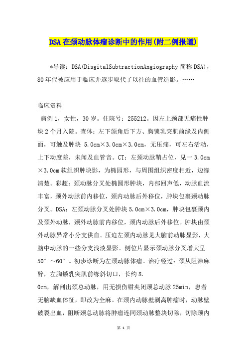 DSA在颈动脉体瘤诊断中的作用(附二例报道)