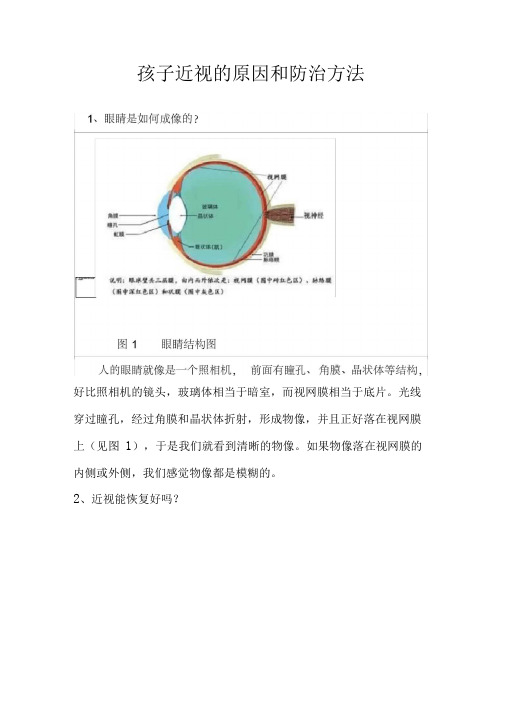 孩子近视的原因和防治方法