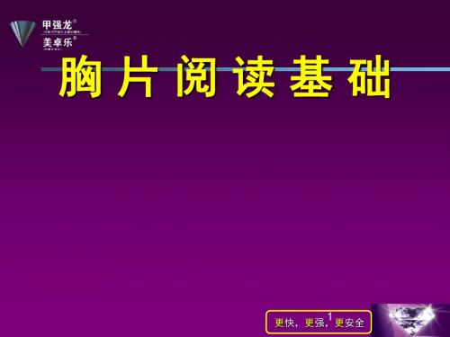 胸片阅读必须知道的几点PPT课件