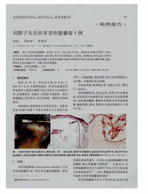 局限于头皮的多发性脂囊瘤1例
