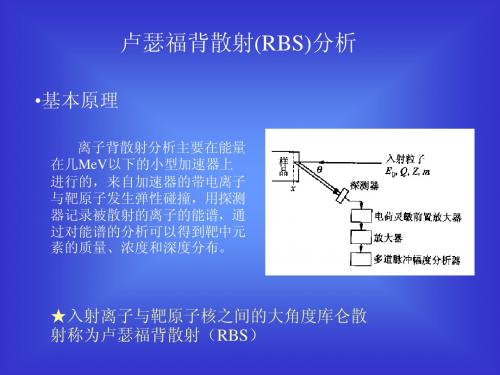 RBS