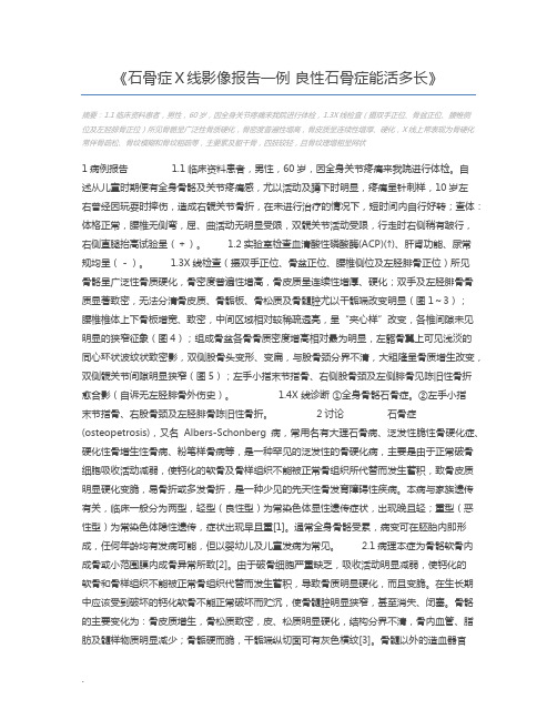 石骨症X线影像报告一例 良性石骨症能活多长
