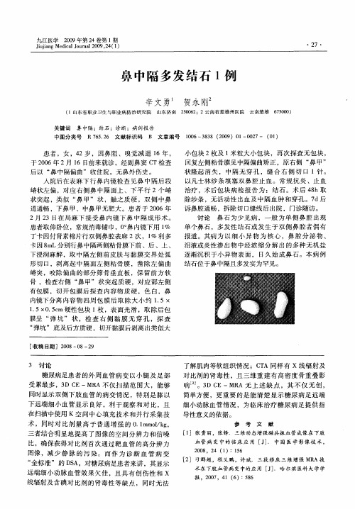 鼻中隔多发结石1例