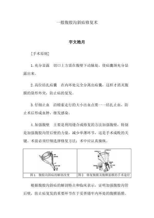 一般腹股沟斜疝修复术手术图谱