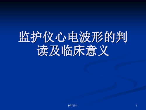 监护仪心电波形的  ppt课件