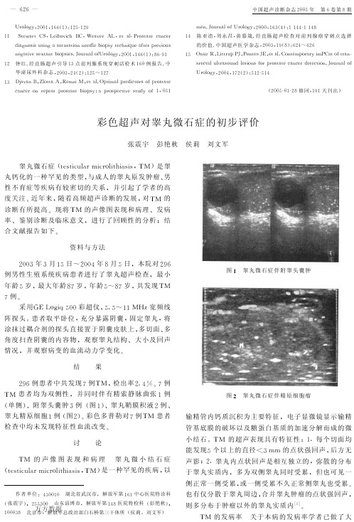 彩色超声对睾丸微石症的初步评价