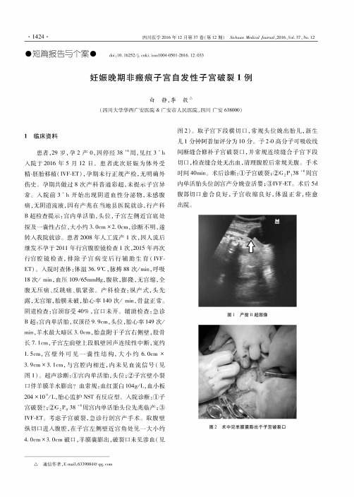 妊娠晚期非瘢痕子宫自发性子宫破裂1例
