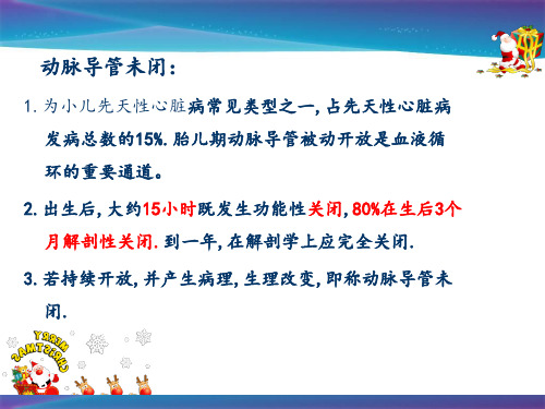 动脉导管未闭 (1)