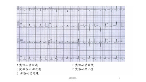 心电图练习题(带图有答案)教案.ppt