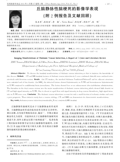 静脉性丘脑梗死的影像学表现(附2例报告及文献回顾)