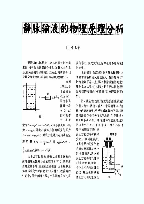 静脉输液的物理原理分析