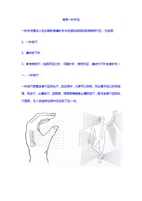 针灸资料：疼疼一针疗法