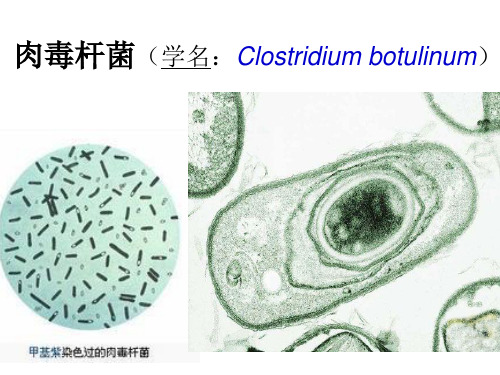 《肉毒杆菌》PPT课件